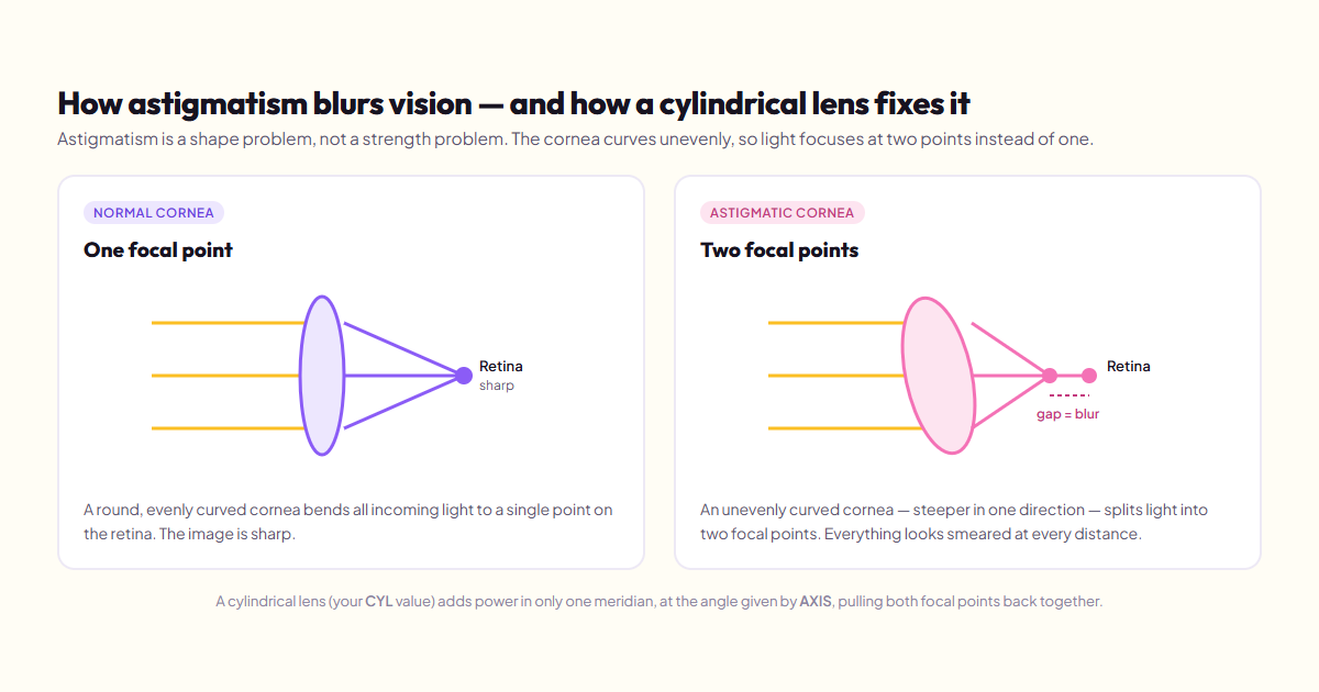 Diagram comparing a normal cornea focusing light to one point on the retina versus an astigmatic cornea splitting light into two focal points, which causes blur